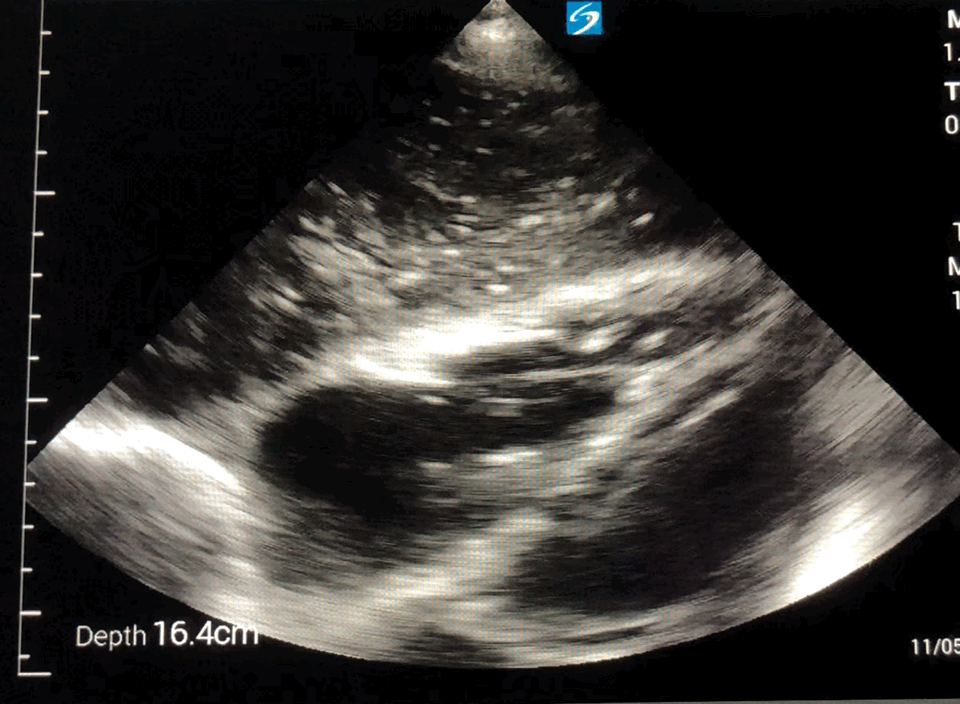 EEU case image missing